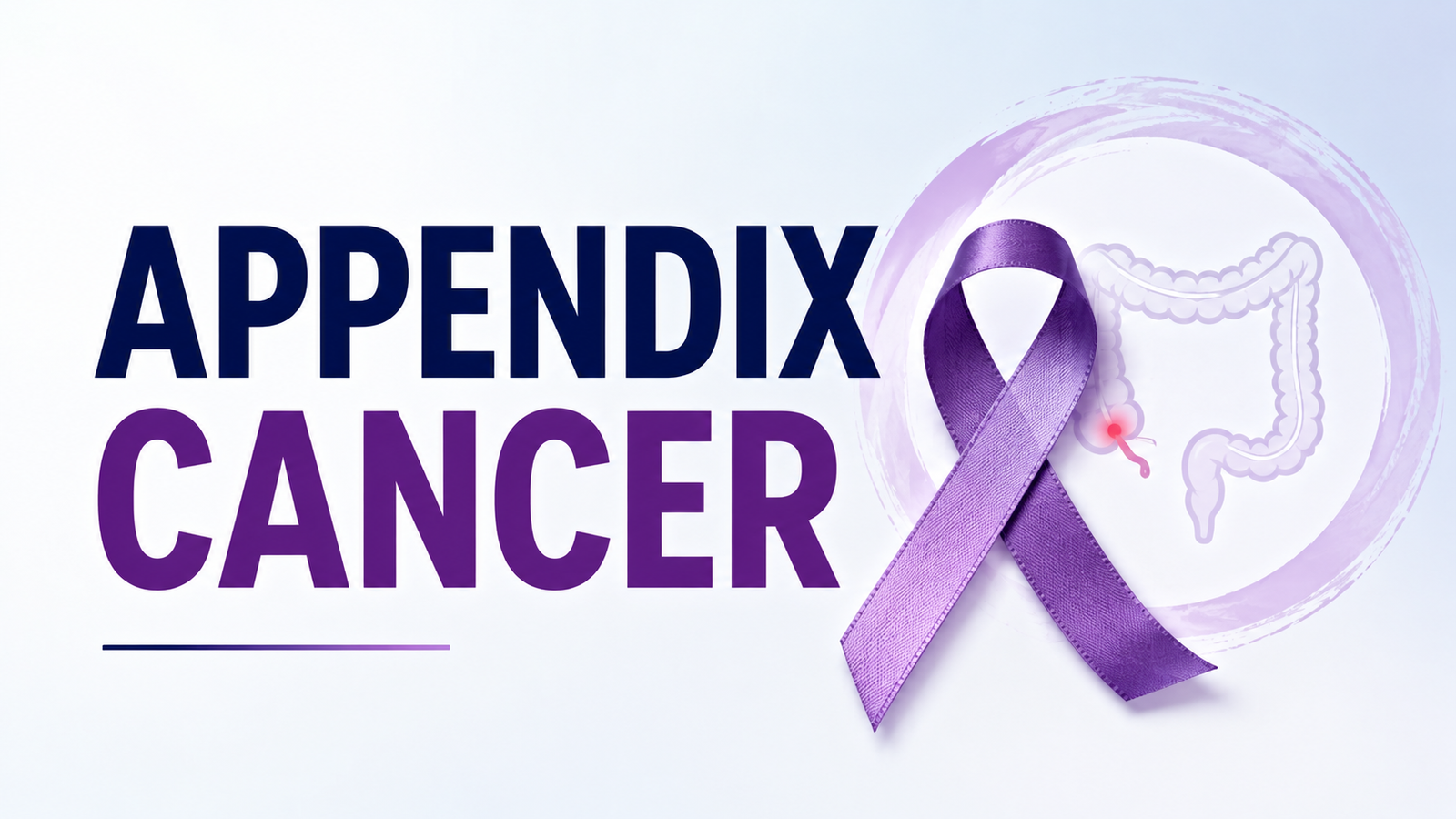 Appendix cancer — symptoms, diagnosis and treatment