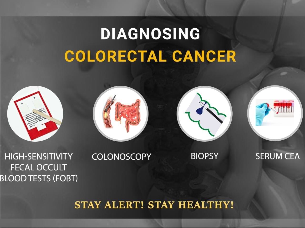 Diagnosis of colorectal cancer