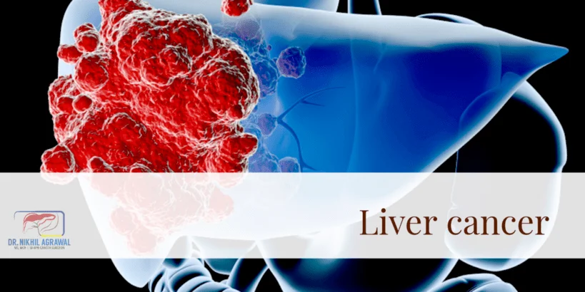 Liver Cancer