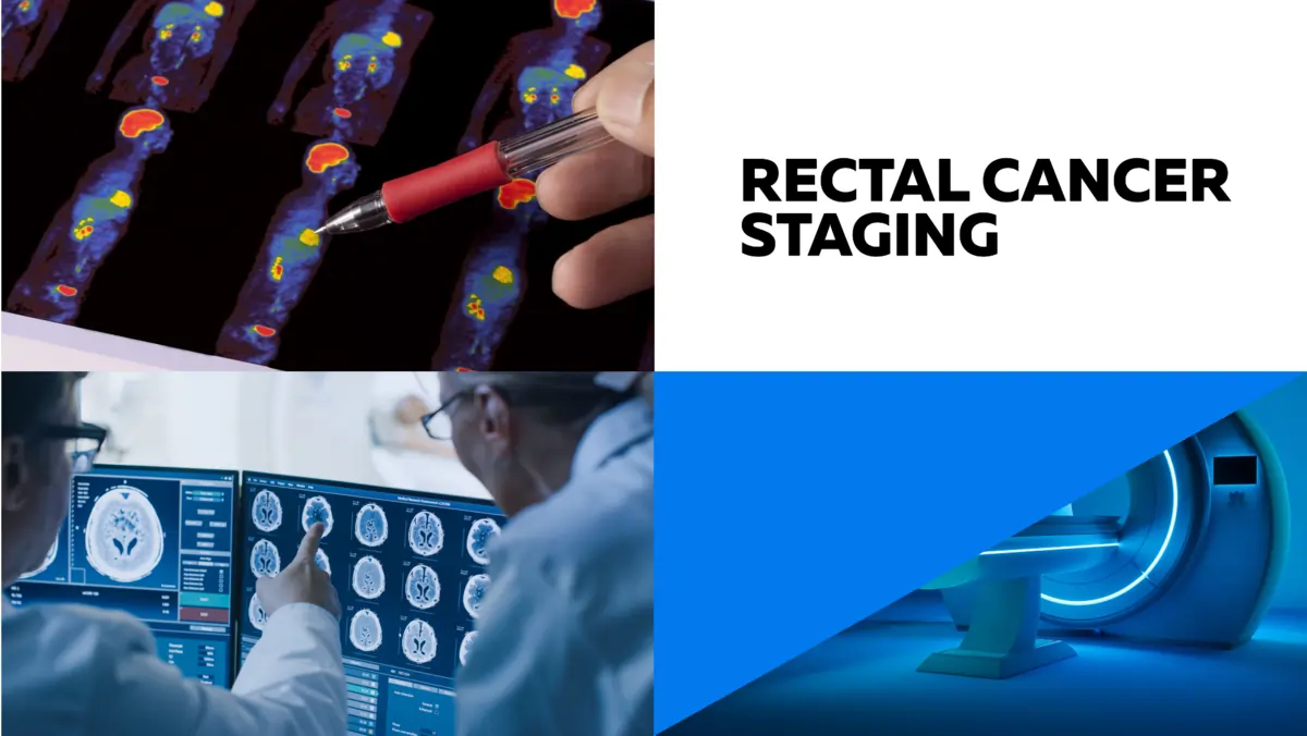 Staging rectal cancer