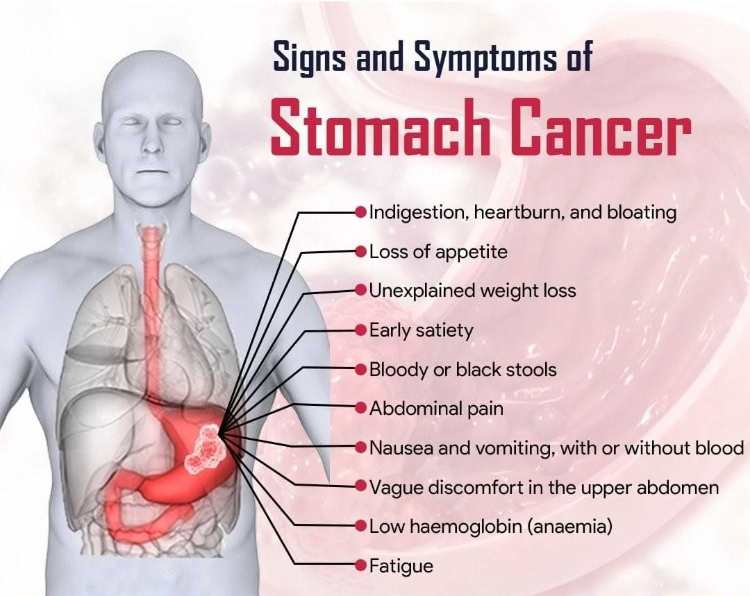 Stomach Cancer Treatment Surgery Dr Nikhil Agrawal Best GI 