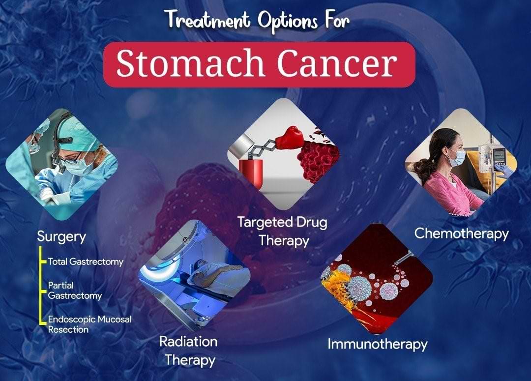 stomach-cancer-treatment-surgery-dr-nikhil-agrawal-best-gi