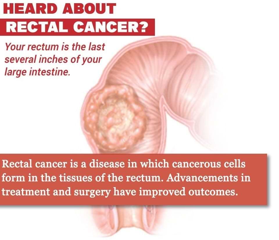 What is rectum and what is rectal cancer?